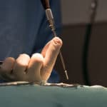 veterinaire lyon mermoz chirurgie orthopédique